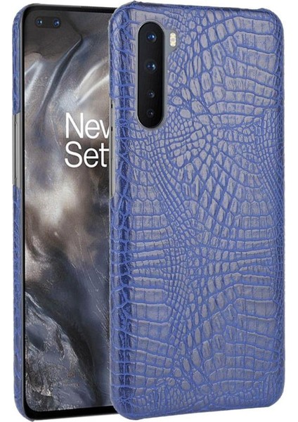 Oneplus Nord Koruyucu Kapak Anti Scratch Için Şık Klasik Kılıf (Yurt Dışından)