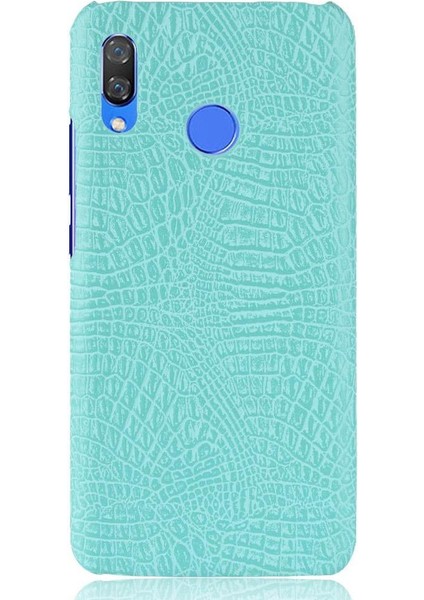 Huawei Nova 3 Uyumluluk Için Şık Klasik Kılıf Koruyucu Kapak Anti (Yurt Dışından) modelleri