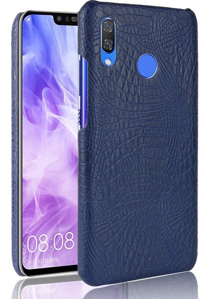 Huawei Nova 3i Anti Scratch Klasik Timsah Için Şık Klasik Kılıf (Yurt Dışından)