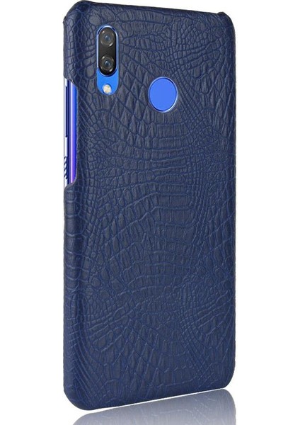 Huawei Nova 3i Anti Scratch Klasik Timsah Için Şık Klasik Kılıf (Yurt Dışından) modelleri
