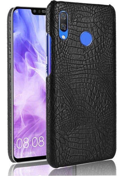 Huawei Nova 3 Uyumluluk Için Şık Klasik Kılıf Koruyucu Kapak Anti (Yurt Dışından)