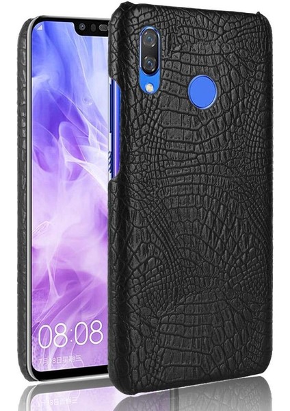 Huawei Nova 3i Anti Scratch Klasik Timsah Için Şık Klasik Kılıf (Yurt Dışından)