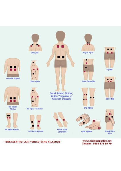 Tens Pedi - Tens Elektrot - 10 Adet 8x5 Çıtçıtlı - Universal fiyatları