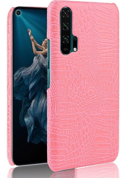 Onur 20 Pro Klasik Timsah Moda Koruyucu Için Şık Klasik Durumda (Yurt Dışından)