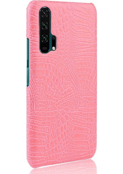 Onur 20 Pro Klasik Timsah Moda Koruyucu Için Şık Klasik Durumda (Yurt Dışından) fiyatları
