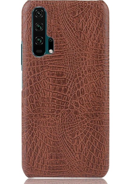 Onur 20 Pro Klasik Timsah Moda Koruyucu Için Şık Klasik Durumda (Yurt Dışından) fiyatları