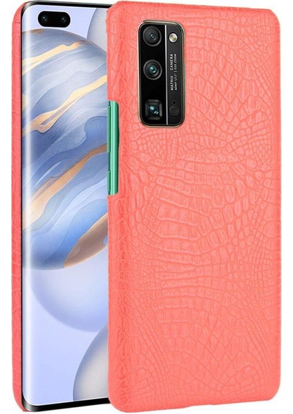 Onur 30 Pro Klasik Timsah Moda Koruyucu Için Şık Klasik Durumda (Yurt Dışından)