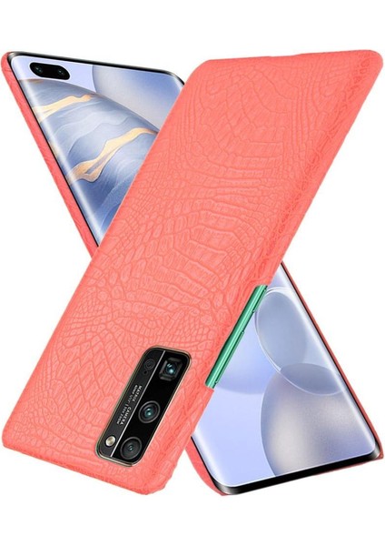 Onur 30 Pro Klasik Timsah Moda Koruyucu Için Şık Klasik Durumda (Yurt Dışından) modelleri