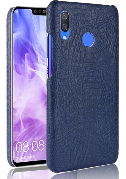 Huawei Nova 3 Telefon Kılıfı (Yurt Dışından)