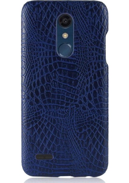 Lg K10 2018 Koruyucu Kapak Için Şık Klasik Kılıf Anti Scratch Klasik (Yurt Dışından)