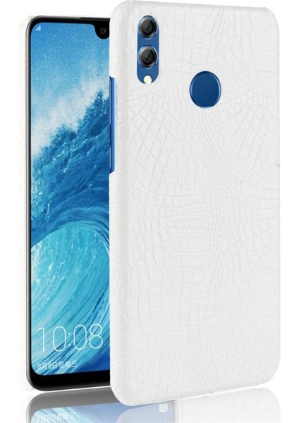 Onur 8x Anti Scratch Koruyucu Kapak Için Şık Klasik Kılıf Klasik (Yurt Dışından)