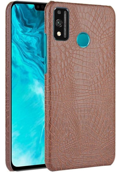 Onur 9x Lite Koruyucu Kapak Için Şık Klasik Kılıf Klasik Timsah (Yurt Dışından)