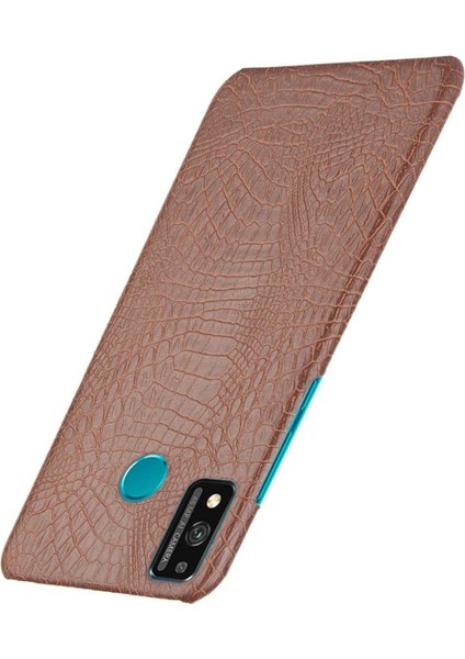 Onur 9x Lite Koruyucu Kapak Için Şık Klasik Kılıf Klasik Timsah (Yurt Dışından) modelleri