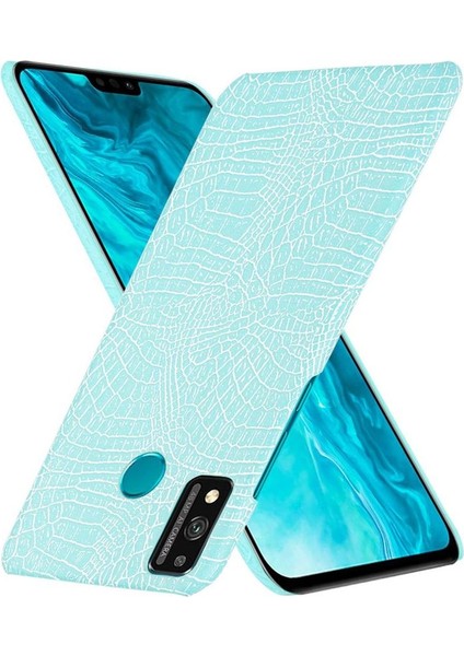 Onur 9x Lite Koruyucu Kapak Için Şık Klasik Kılıf Klasik Timsah (Yurt Dışından) fırsatları