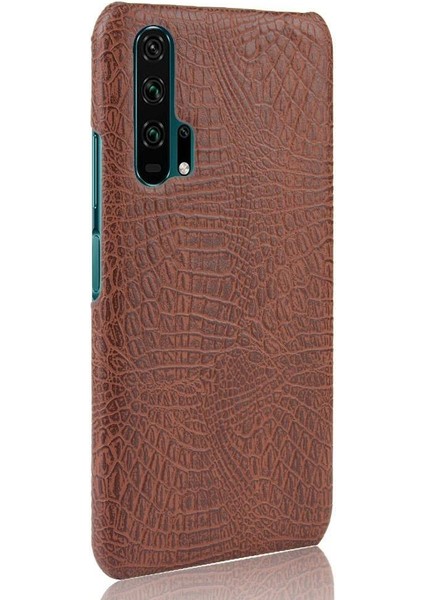 Onur 20 Pro Klasik Timsah Moda Koruyucu Için Şık Klasik Durumda (Yurt Dışından) fiyatları