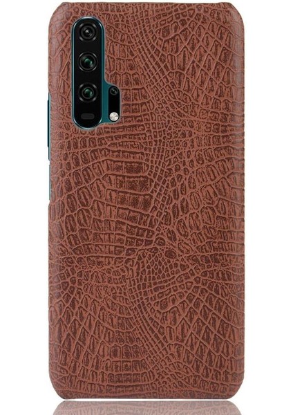 Onur 20 Pro Klasik Timsah Moda Koruyucu Için Şık Klasik Durumda (Yurt Dışından) modelleri
