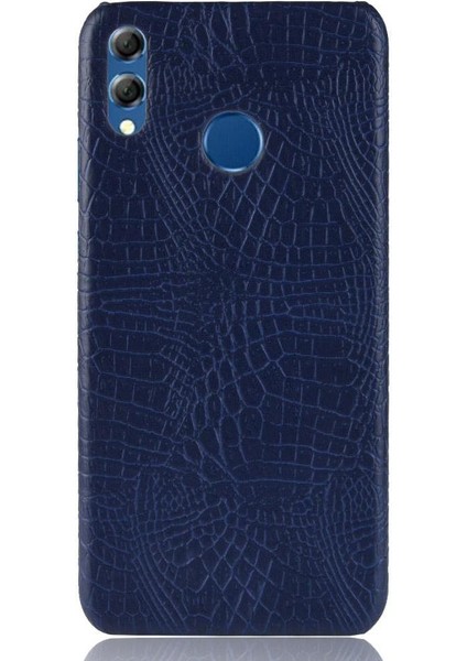 Onur 8x Anti Scratch Koruyucu Kapak Için Şık Klasik Kılıf Klasik (Yurt Dışından) modelleri