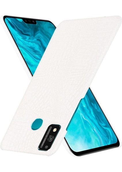 Onur 9x Lite Koruyucu Kapak Için Şık Klasik Kılıf Klasik Timsah (Yurt Dışından) indirimleri