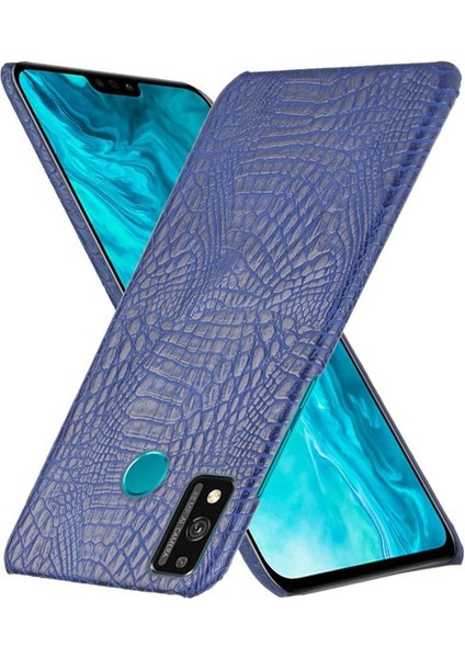 Onur 9x Lite Koruyucu Kapak Için Şık Klasik Kılıf Klasik Timsah (Yurt Dışından) modelleri