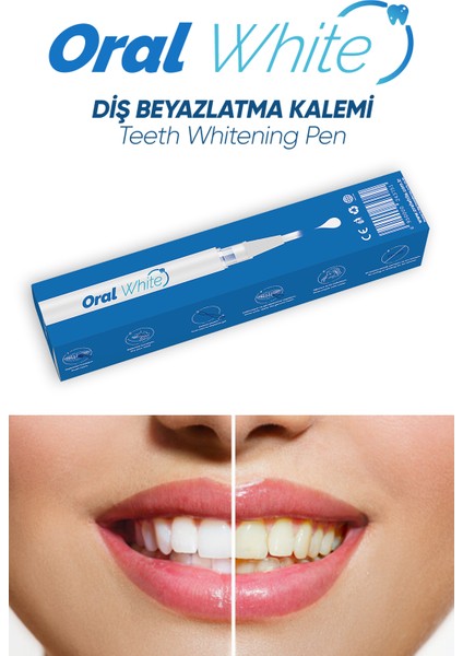 Oral White Cleaning Pro Diş Kalem 2ml