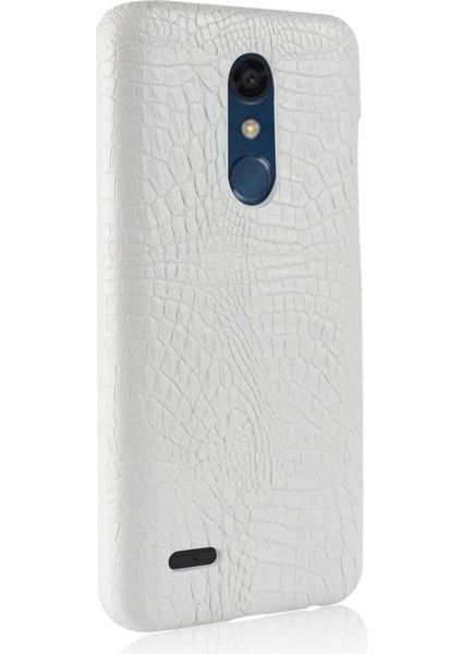 Lg K10 2018 Koruyucu Kapak Için Şık Klasik Kılıf Anti Scratch Klasik (Yurt Dışından)