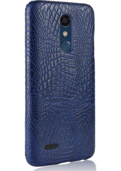Lg K10 2018 Koruyucu Kapak Için Şık Klasik Kılıf Anti Scratch Klasik (Yurt Dışından) modelleri