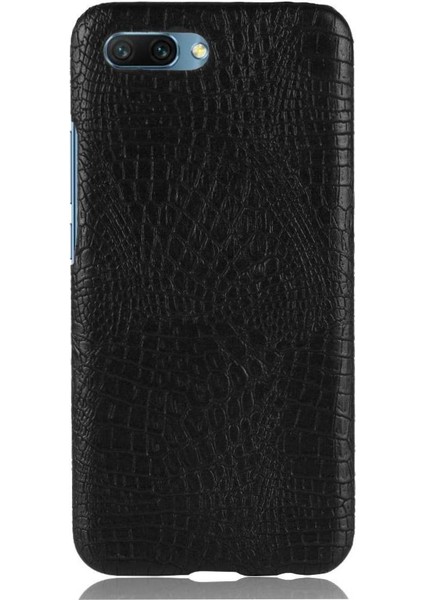 Onur 10 Anti Scratch Klasik Timsah Moda Için Şık Klasik Durumda (Yurt Dışından)