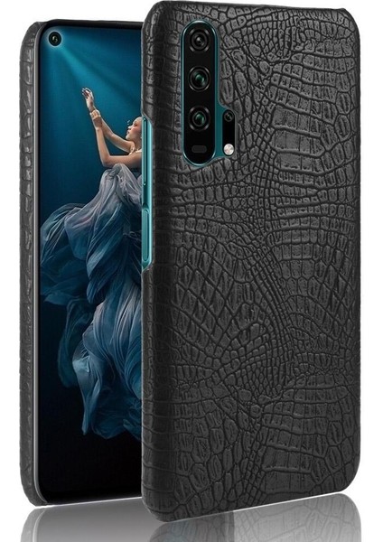 Onur 20 Pro Klasik Timsah Moda Koruyucu Için Şık Klasik Durumda (Yurt Dışından)