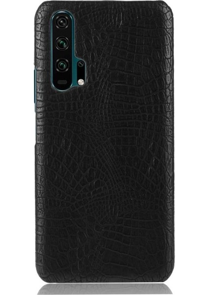 Onur 20 Pro Klasik Timsah Moda Koruyucu Için Şık Klasik Durumda (Yurt Dışından) modelleri
