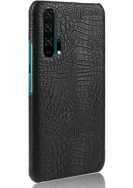 Onur 20 Pro Klasik Timsah Moda Koruyucu Için Şık Klasik Durumda (Yurt Dışından) fırsatları