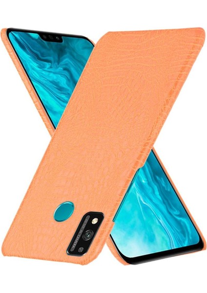 Onur 9x Lite Koruyucu Kapak Için Şık Klasik Kılıf Klasik Timsah (Yurt Dışından) fırsatları