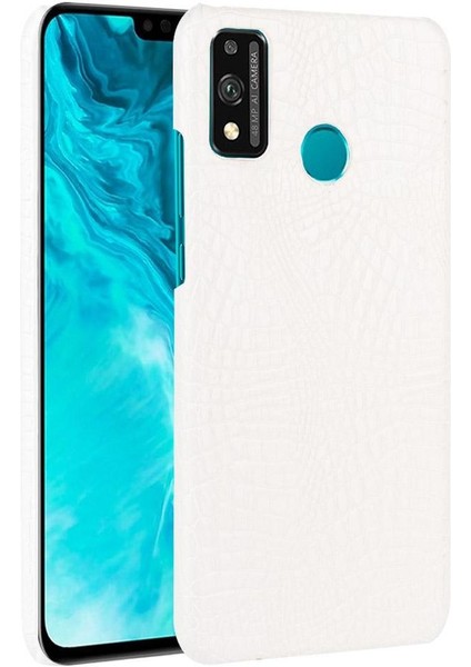Onur 9x Lite Koruyucu Kapak Için Şık Klasik Kılıf Klasik Timsah (Yurt Dışından)