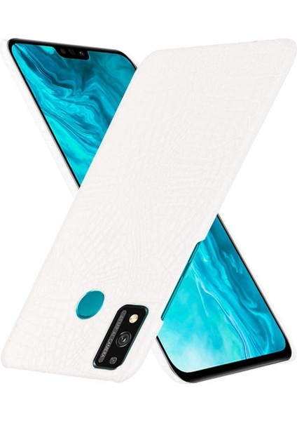 Onur 9x Lite Koruyucu Kapak Için Şık Klasik Kılıf Klasik Timsah (Yurt Dışından) indirimleri