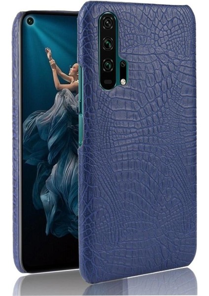 Onur 20 Pro Klasik Timsah Moda Koruyucu Için Şık Klasik Durumda (Yurt Dışından)
