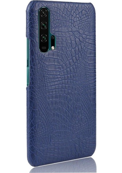 Onur 20 Pro Klasik Timsah Moda Koruyucu Için Şık Klasik Durumda (Yurt Dışından) fiyatları