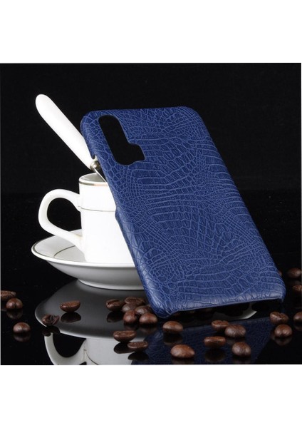 Onur 20 Pro Klasik Timsah Moda Koruyucu Için Şık Klasik Durumda (Yurt Dışından) fırsatları