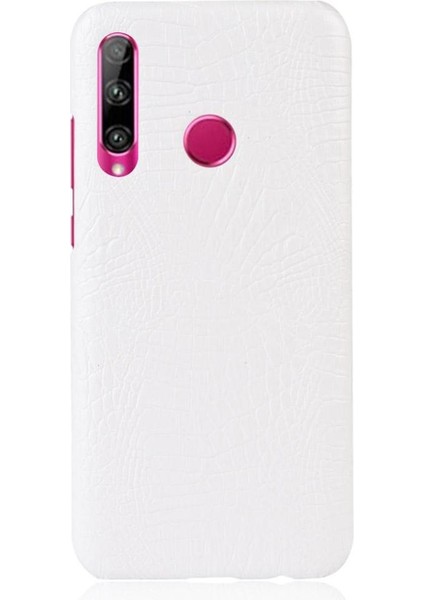Onur 20 Lite Uyumluluk Koruyucu Kapak Anti Için Şık Klasik Durumda (Yurt Dışından)