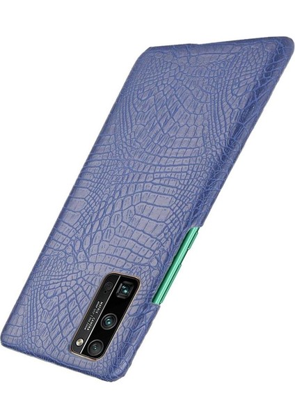 Onur 30 Pro Klasik Timsah Moda Koruyucu Için Şık Klasik Durumda (Yurt Dışından) fiyatları