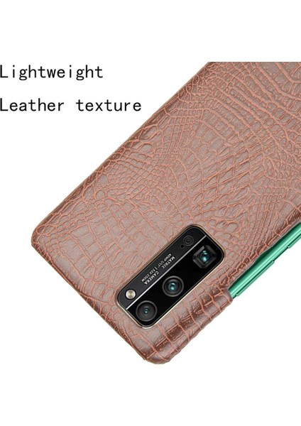 Onur 30 Pro Klasik Timsah Moda Koruyucu Için Şık Klasik Durumda (Yurt Dışından) fırsatları