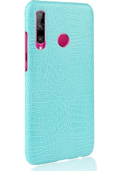 Onur 20 Lite Uyumluluk Koruyucu Kapak Anti Için Şık Klasik Durumda (Yurt Dışından)