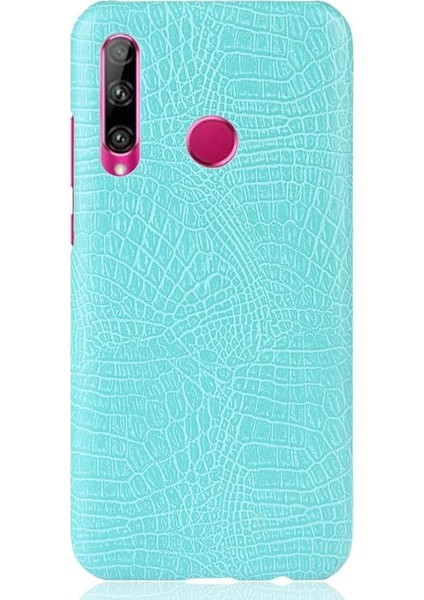 Onur 20 Lite Uyumluluk Koruyucu Kapak Anti Için Şık Klasik Durumda (Yurt Dışından)
