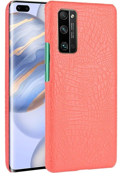 Onur 30 Pro Klasik Timsah Moda Koruyucu Için Şık Klasik Durumda (Yurt Dışından)