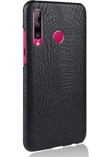Onur 20 Lite Uyumluluk Koruyucu Kapak Anti Için Şık Klasik Durumda (Yurt Dışından)