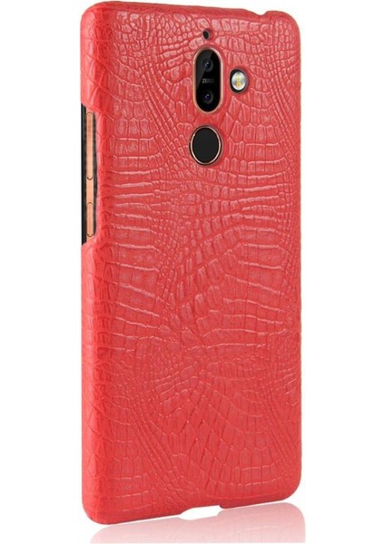 Nokia 7 Plus Anti Scratch Klasik Timsah Kapağı Için Şık Klasik Kılıf (Yurt Dışından)