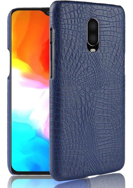 Oneplus 6t Klasik Timsah Moda Koruyucu Için Şık Klasik Kılıf (Yurt Dışından)