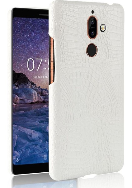 Nokia 7 Plus Anti Scratch Klasik Timsah Kapağı Için Şık Klasik Kılıf (Yurt Dışından)