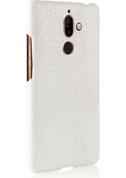 Nokia 7 Plus Anti Scratch Klasik Timsah Kapağı Için Şık Klasik Kılıf (Yurt Dışından)