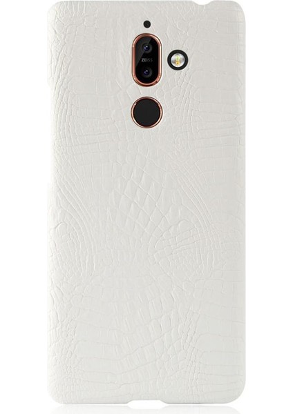 Nokia 7 Plus Anti Scratch Klasik Timsah Kapağı Için Şık Klasik Kılıf (Yurt Dışından)