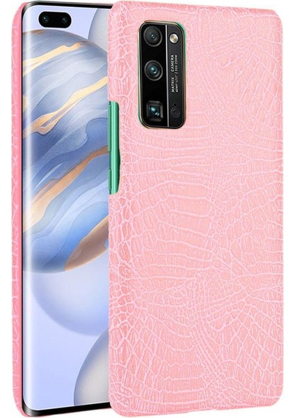 Onur 30 Pro Klasik Timsah Moda Koruyucu Için Şık Klasik Durumda (Yurt Dışından)