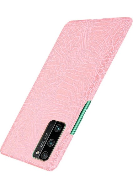 Onur 30 Pro Klasik Timsah Moda Koruyucu Için Şık Klasik Durumda (Yurt Dışından) fiyatları